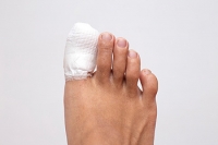When to See the Podiatrist for a Broken Toe