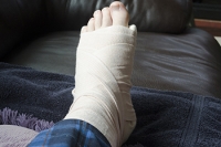 Diagnosis of Foot Fractures