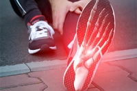 Causes of Foot Stress Fractures