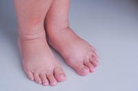 Why the Feet Swell During Pregnancy