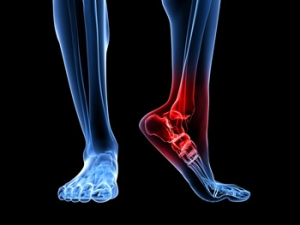 Types of Foot Pain